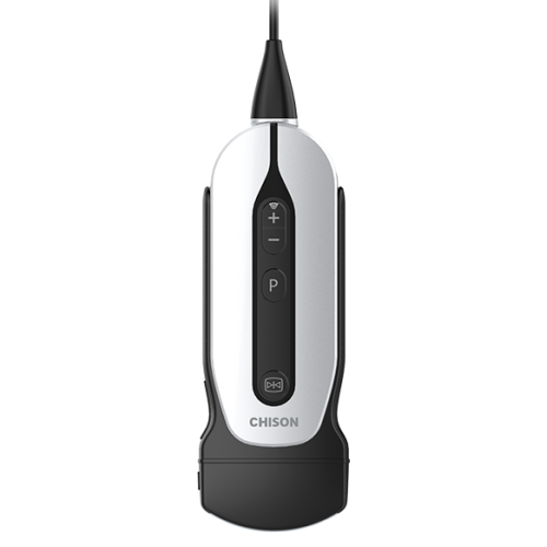 portable ultrasound machine for pregnancy
